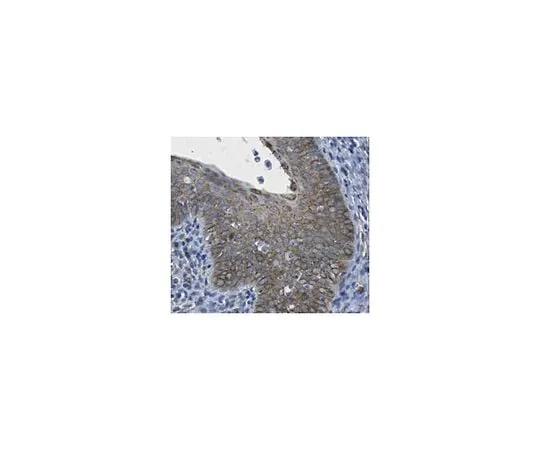 62-8471-51 Anti-Dio3 ABS1073