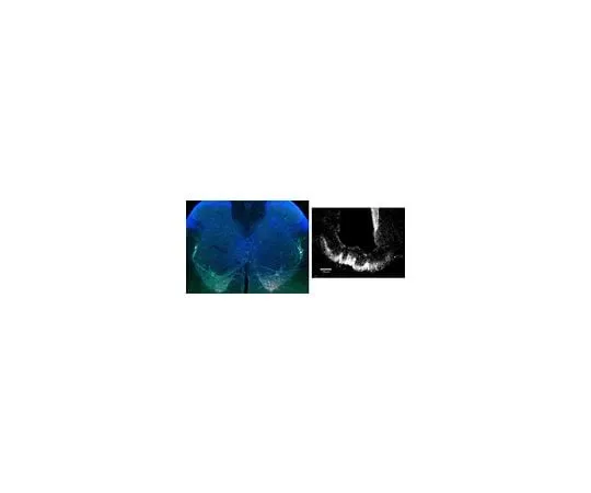 62-8468-63 Anti-pro-TRH ABN1658