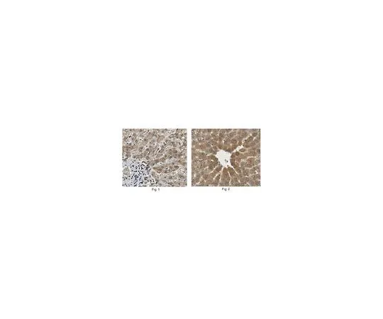 62-8473-62 Anti-Matriptase-2/TMPRSS6 ABT317