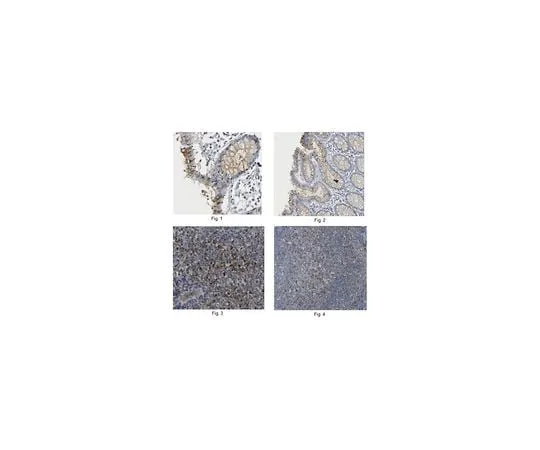 62-8525-72 Anti-Claudin-4, clone 10B4.3 MABT140