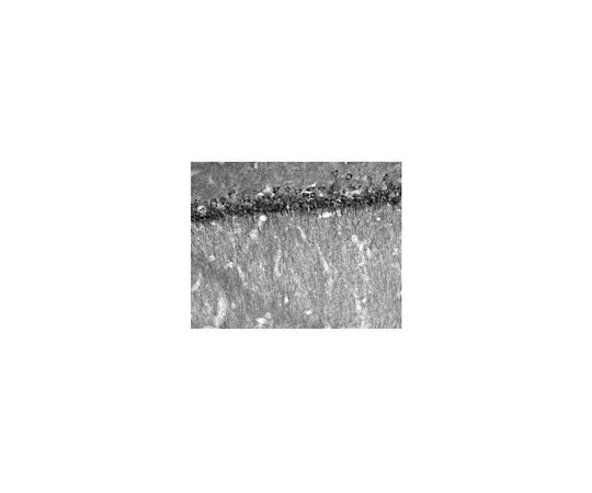 62-8518-20 Anti-WAVE-1 Antibody, clone K91/36 , MABN503 MABN503