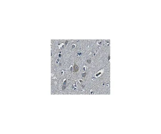 62-8517-50 Anti-NB thymosin beta (TMSB15A), Clone 4A6.3 MABN358