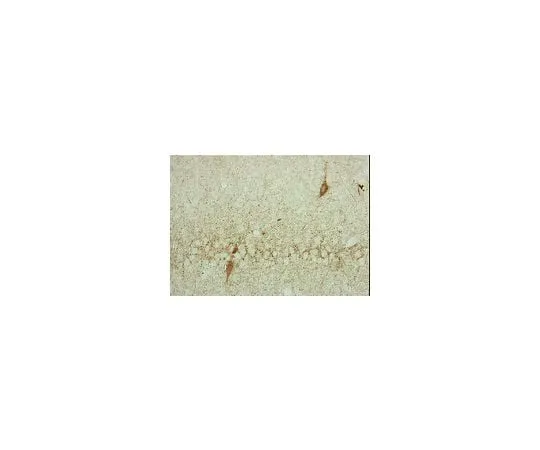 62-8488-95 Anti-Glutamate Decarboxylase, 65 kDa Isoform, clone GAD-6; 100 μg MAB351