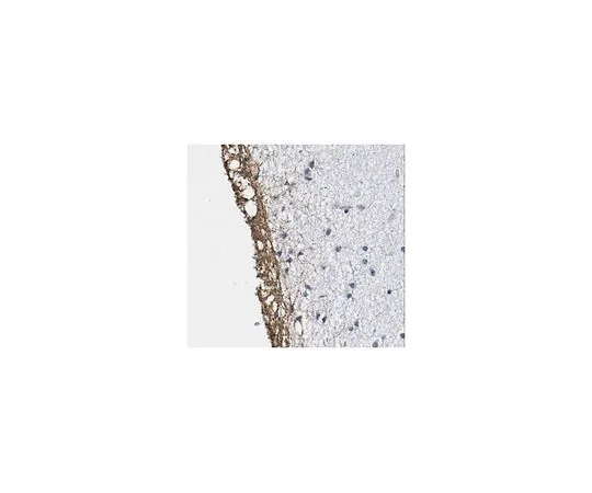 62-8517-41 Anti-peptidyl-citrulline, clone F95 MABN328