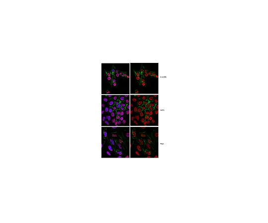 62-8505-75 Anti-2,2,7-Trimethylguanosine clone K121 MABE302
