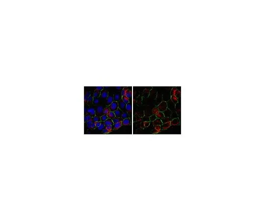 62-8472-30 Anti-Tensin-3; 100 μg ABT29