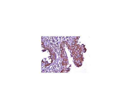 62-8469-26 Anti-VEGF; 100 μg ABS82