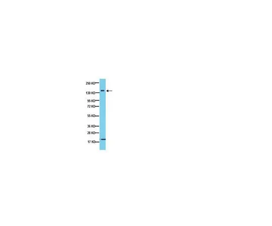 62-8497-24 Anti-Neurofilament 160 kDa, clone NN18; 40 μg MAB5254