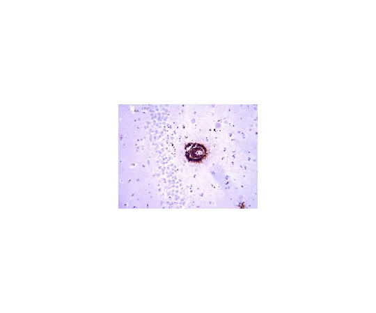 62-8516-32 Anti-Amyloid β40, clone G2-10; 50 μg MABN11