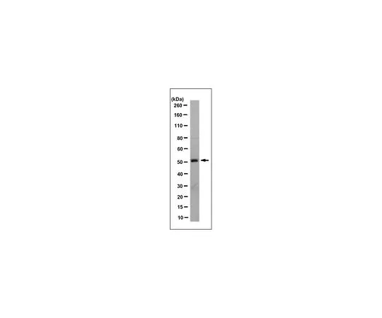 62-8496-27 Anti-Wilms' Tumor Antibody, NT clone 6F-H2, Ascites Free MAB4234-C
