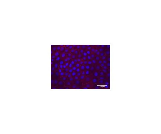 62-8526-23 Anti-CD167a/DDR1 Antibody, clone 5D5 MABT333