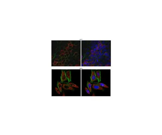 62-8472-61 Anti-Kinectin ABT98