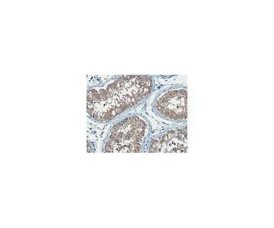 62-8519-87 Anti-Retinal Dehydrogenase 1/ALDH1A1 Antibody, clone 8D7.1 MABN838
