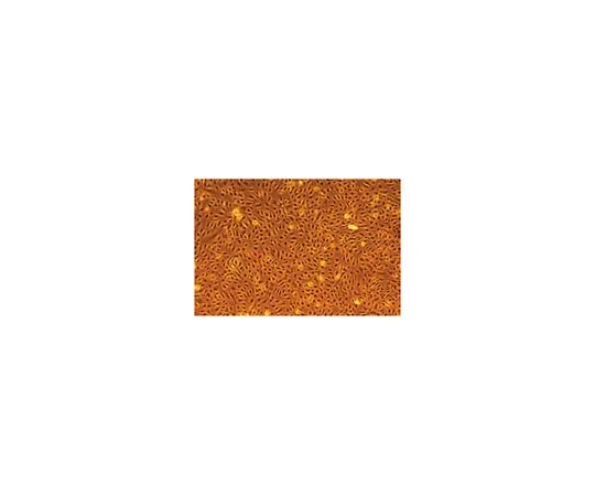 62-8531-93 EndoGRO Human Umbilical Vein Endothelial Cells (HUVEC); 500,000 cells/vial SCCE001