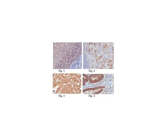 62-8501-26 Anti-S1PR2/EDG5, clone 6E8.1; 100 μg MABC95
