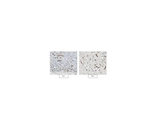 62-8517-39 Anti-Coronin-1A, clone 2E4.1 Antibody MABN319