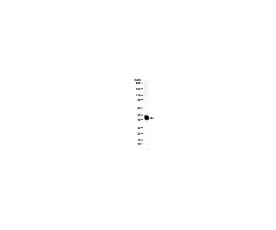 62-8472-17 Anti-Ferrochelatase ABS2124