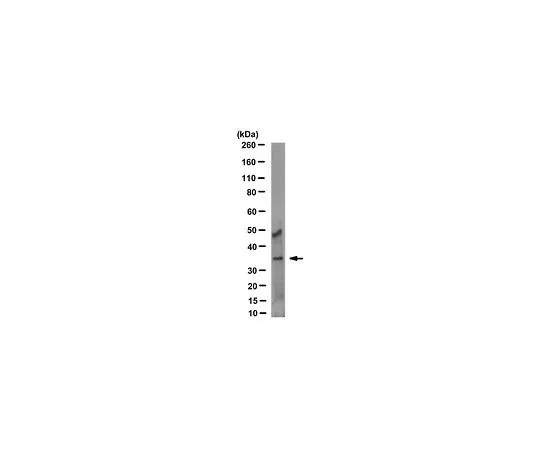 62-8524-69 Anti-Annexin A3 Antibody, clone 9996-1-3M1/3L7-5 MABS1329