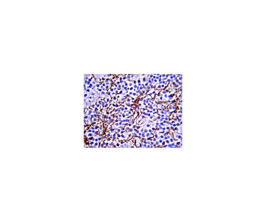 62-8530-56 IgG1, Mouse; 1 mg PP100