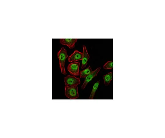 62-8519-10 Anti-KDM4A, clone5H1 MABN685