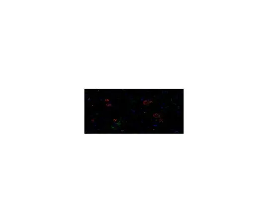 62-8517-11 Anti-amyloid beta peptide (MOAB-2), pan, clone 6C3 MABN254