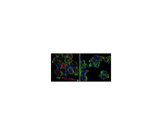 62-8502-68 Anti-S100A4 Antibody, clone 9D5.1 MABC653