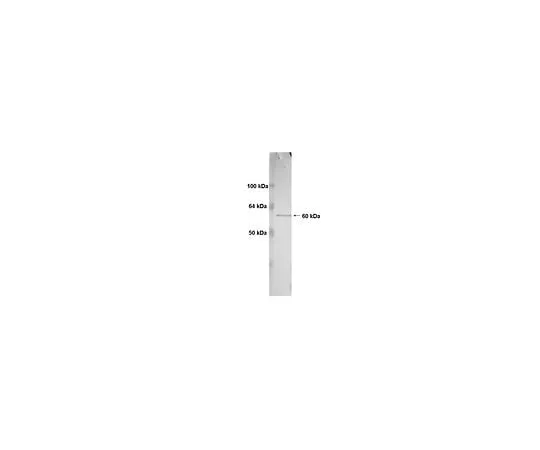 62-8491-88 MOUSE ANTI-HUMAN MT1-MMP catalytic domain, clone 3G4.2; 100 μg MAB1767