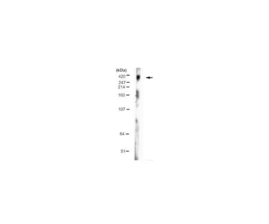 62-8498-10 Anti-Huntingtin, a.a. 1-82; 100 μL MAB5492