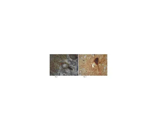 62-8516-60 Anti-pan-MAGUK, clone K28/86; 100 μg MABN72