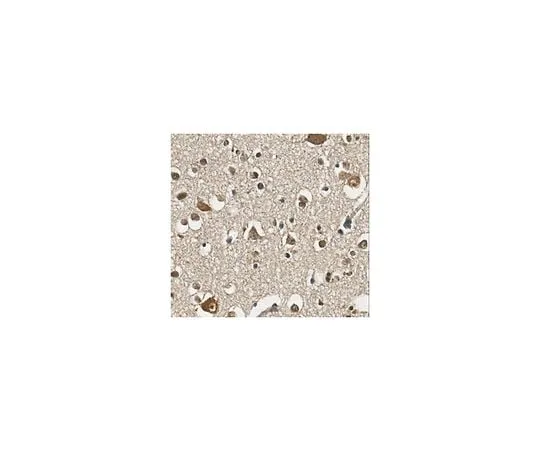 62-8473-63 Anti-Protocadherin 19 Antibody ABT318 ABT318