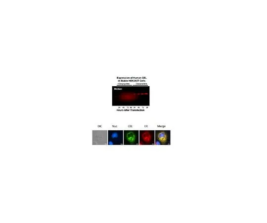 62-8471-31 Anti-Bile salt-activated lipase ABS1022