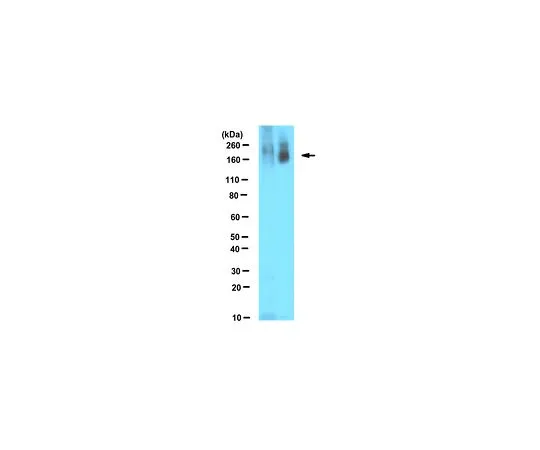 62-8502-25 Anti-Poly ADP-ribose, clone 10H MABC547