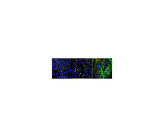 62-8472-25 Anti-ARHGEF6 ABT15