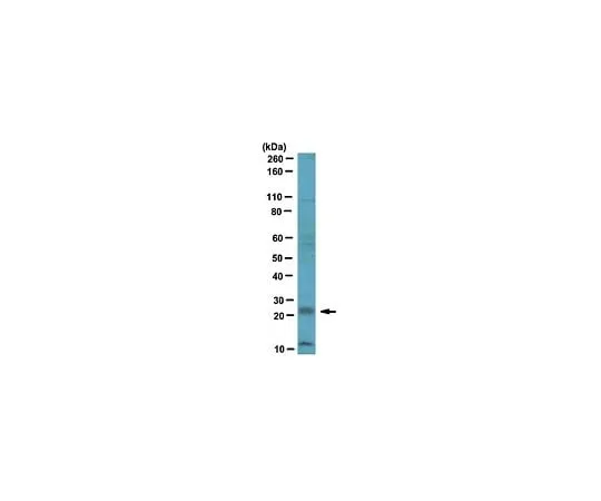 62-8472-26 Anti-RGS4; 100 μL ABT17