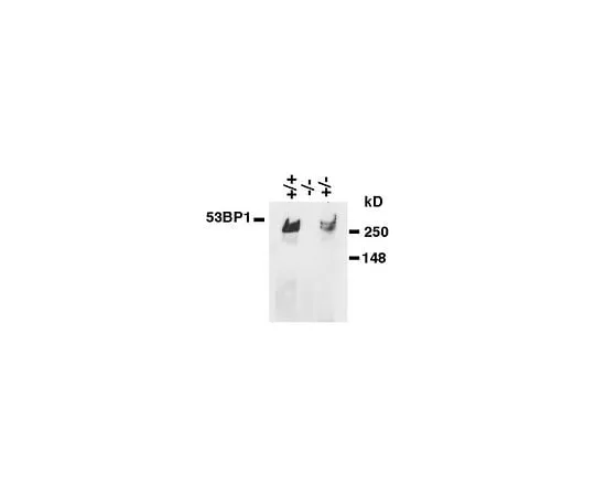 62-8495-69 Anti-53BP1, clone BP18; 100 μg MAB3804