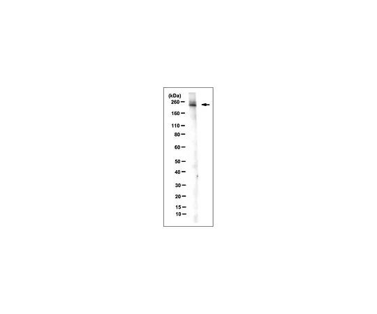 62-8507-55 Anti-Mi-2?, clone 16G4 MABE914