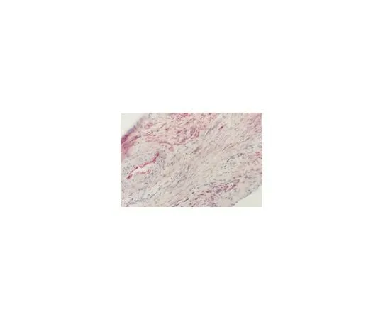 62-8495-91 Anti-Angiotensin Converting Enzyme, clone 9B9; 100 μg MAB4051