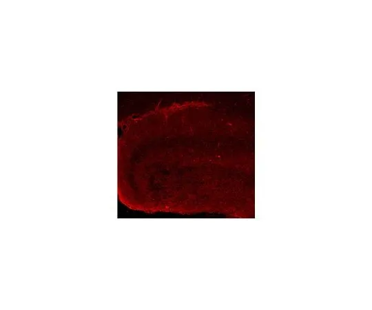 62-8468-68 Anti-phospho-Pannexin 1 (Tyr308) ABN1680