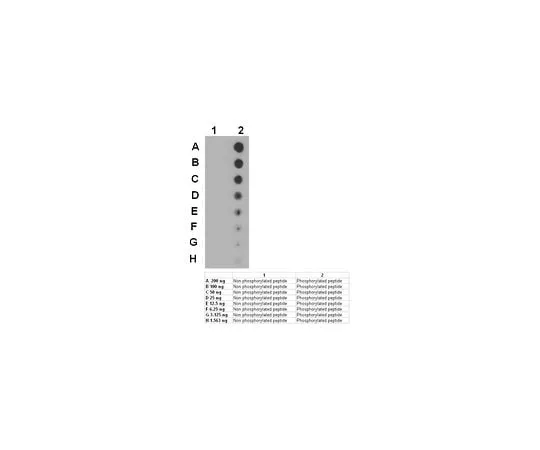 62-8472-44 Anti-phospho-Peak (Tyr665) ABT52