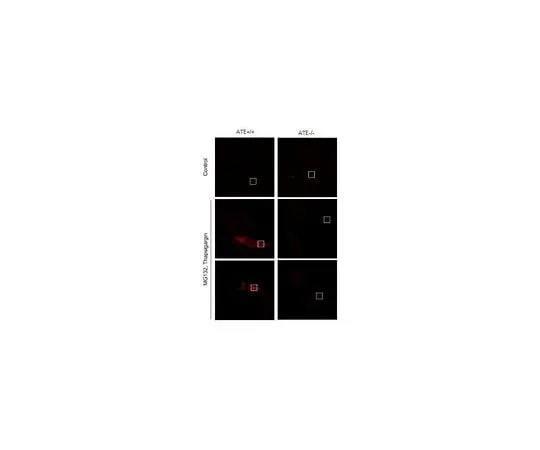 62-8472-15 Anti-BiP (GRP78) Antibody, arginylated (Nt-Glu19) ABS2103