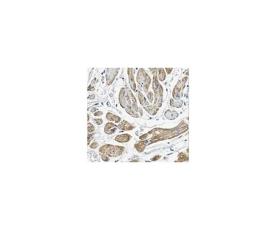 62-8518-21 ANTI-VDAC1 Antibody, clone N152B/23 , Cat. No. MABN504 MABN504