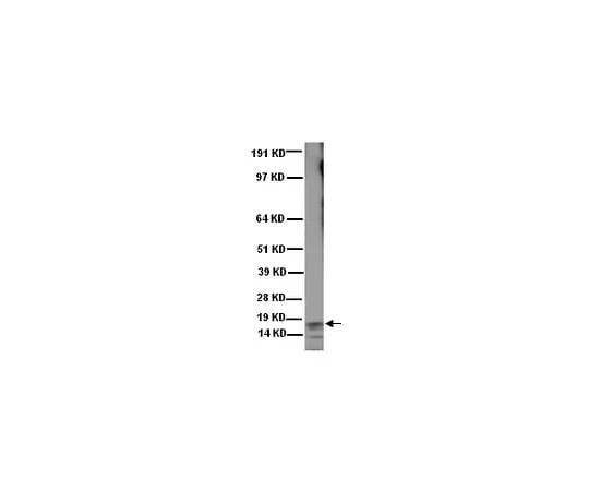 62-8491-42 Anti-Frataxin, exon 4, clone 1G2; 100 μL MAB1594