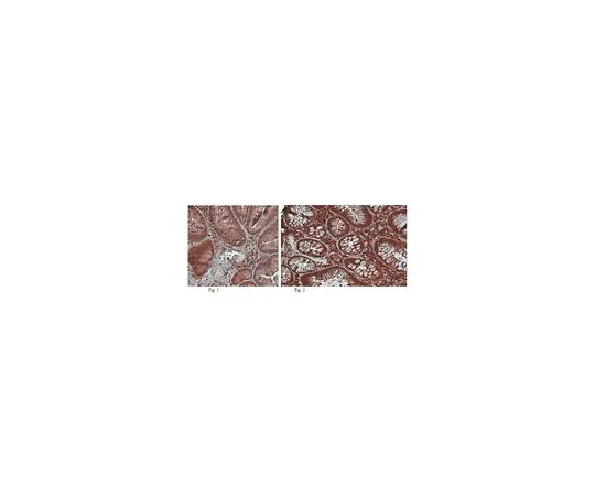 62-8525-51 Anti-Arp2/3 complex, clone 13C9; 100 μL MABT95