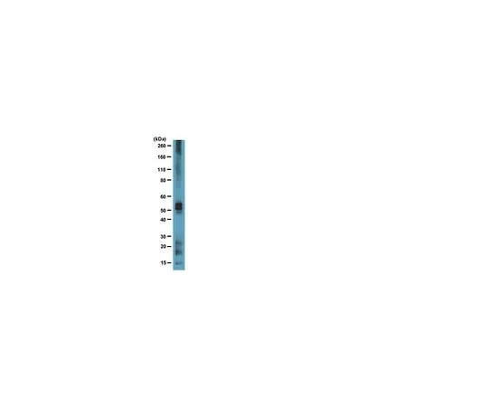 62-8493-45 Anti-Tau, clone Tau 7; 100 μg MAB2239