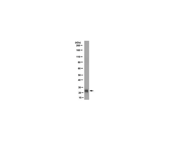 62-8519-51 Anti-VSNL1, clone 2D11 MABN762