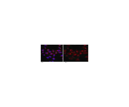 62-8525-53 Anti-Girdin, C-terminus, clone 10E6.1 MABT100