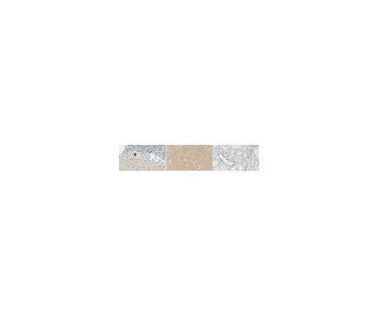 62-8519-67 Anti-VAP-B Antibody, clone 3C6.2 MABN791