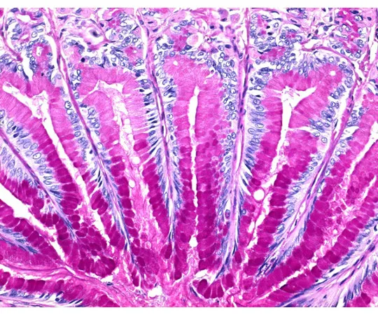 61-0286-87 ISOSLIDE(R) PAS with Slide Glass And Reference Tissue for The Detection Of Polysaccharides in Tissue 100408 1ST 1.00408.0001