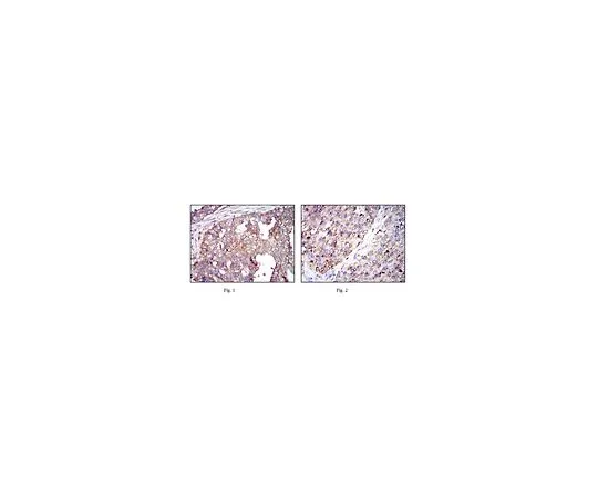 62-8519-19 Anti-G6PD, clone 2H7 MABN696
