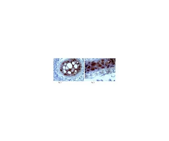 62-8525-46 Anti-Aggrecan, clone 1-C-6; 100 μg MABT84